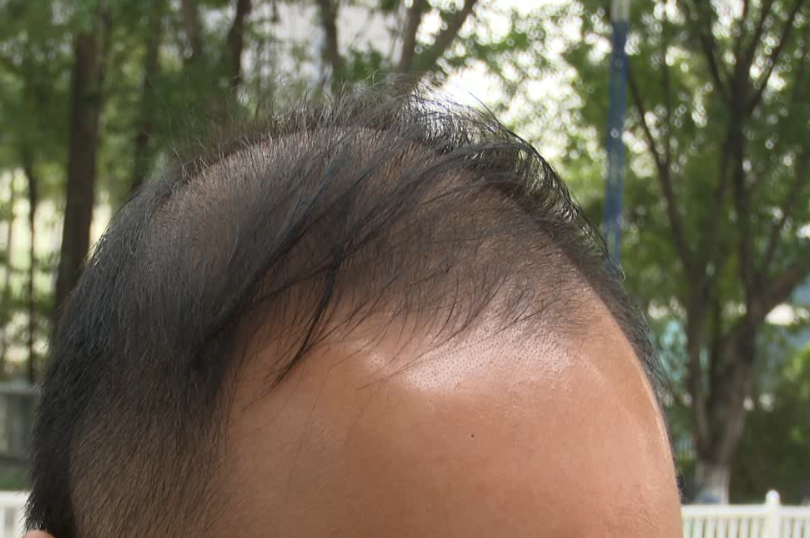 夢見換發(fā)型,夢見換發(fā)型是什么意思 周公解夢