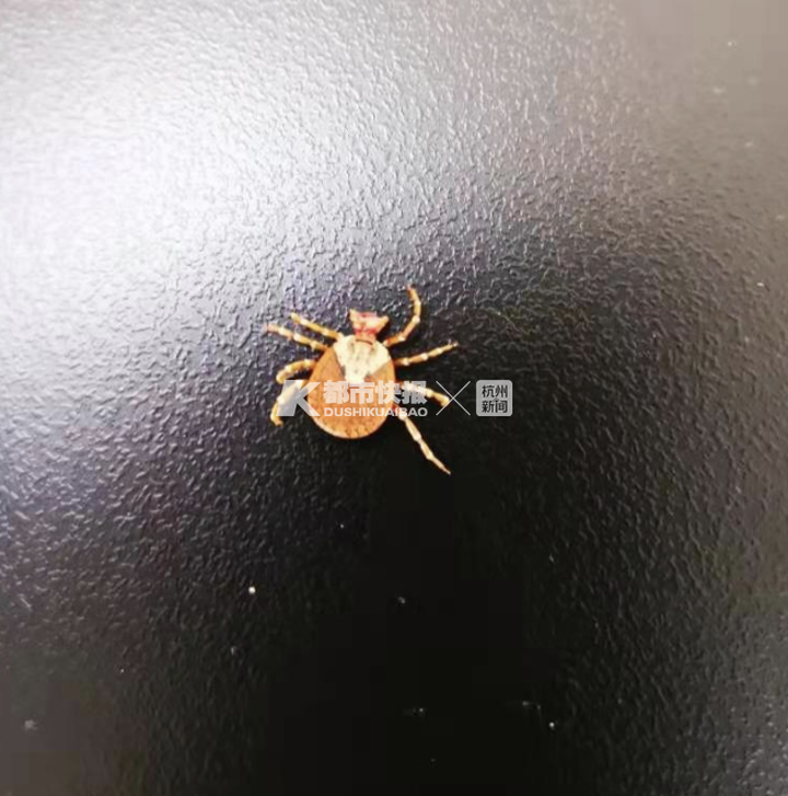 昨夜,杭州有医院连着接诊两例蜱虫咬伤