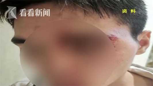 玩“密室逃脱”受伤，脸上缝了4针！小伙索赔遭拒 店家：他讹我们