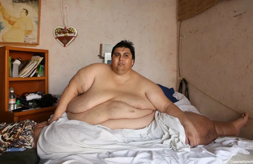 世界上最胖的那些人...他们最后怎么样了？