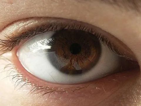 为什么人的眼睛有不同颜色？