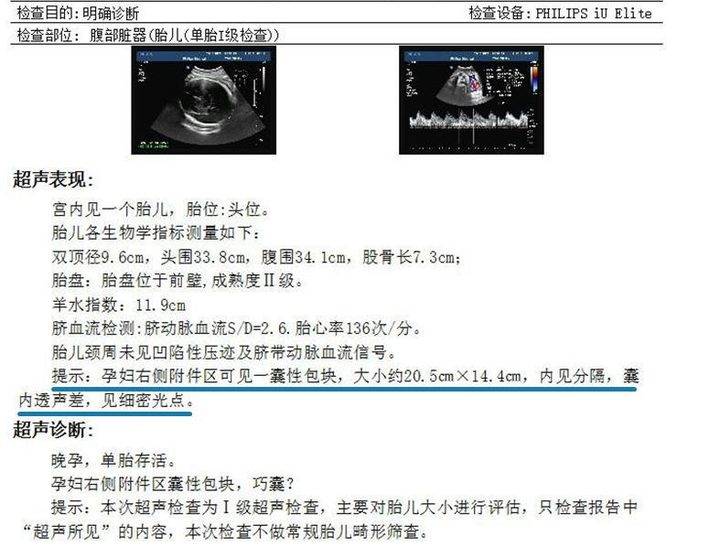 四号足球多大尺寸（孕妈妈肚里带个“足球”，烟台这家医院助力卵巢囊肿产妇顺利生产）