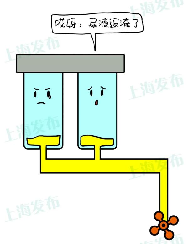 腰子是肾吗的解释（肾脏最大的工作是血液处理）