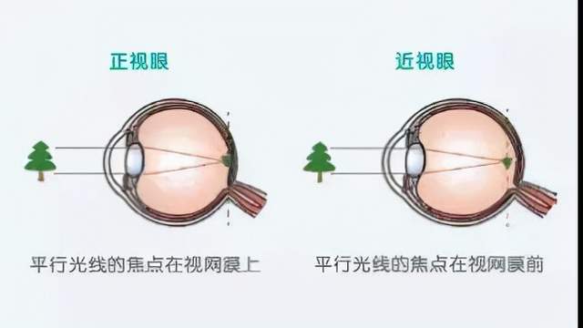 防近视的建议十条（预防近视的建议10条）-第2张图片-华展网