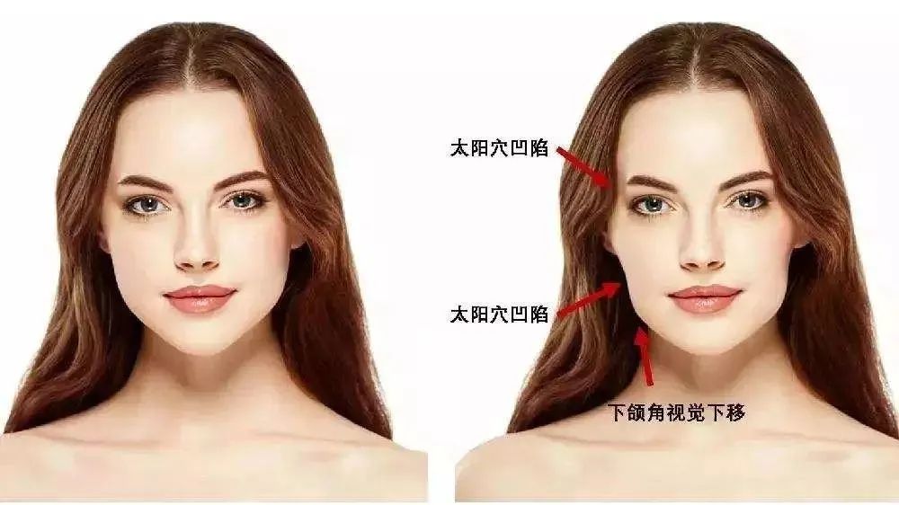 就是它们,一直在偷偷地改变你的脸型