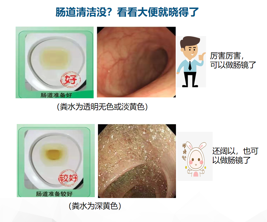 肠镜，一项能救命的检查！超全攻略来了