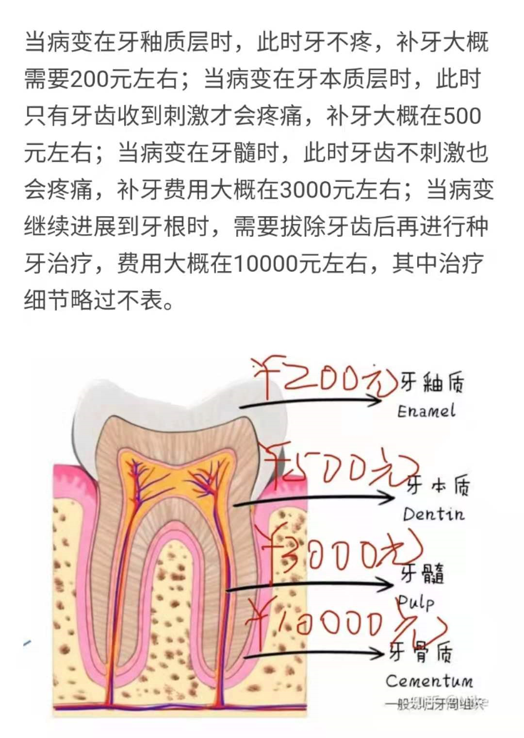 我就是那个被牙疼折磨的女孩