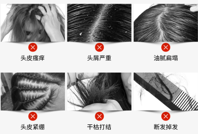 中国发证“认可”，脱发终于有救了
