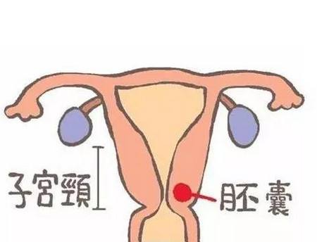 怀孕50天左右彩超单上写什么？这个男孩彩超单，5大数据一看就懂
