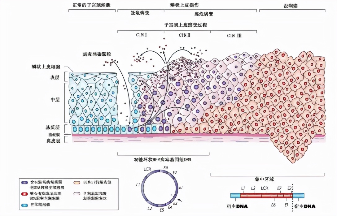 干货 | HPV疫苗该不该打？先了解什么是HPV