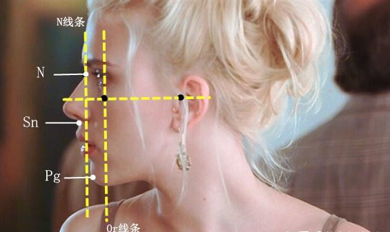 女生遇上面部凹陷，不仅是显老的问题！整形医生教你怎么正确应对