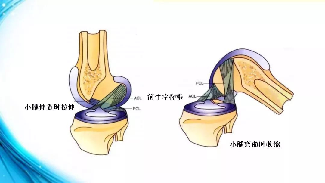 网球结节(网球肘到底是反手还是正手！)