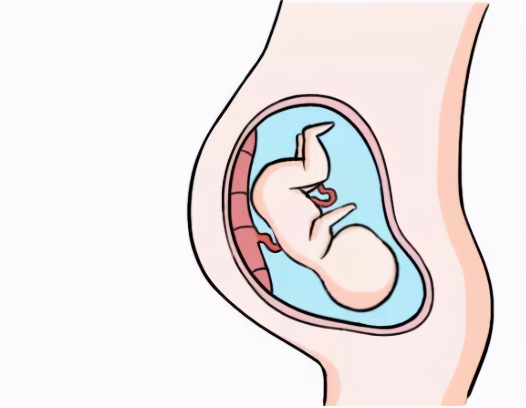 胎盘附于子宫前壁图片