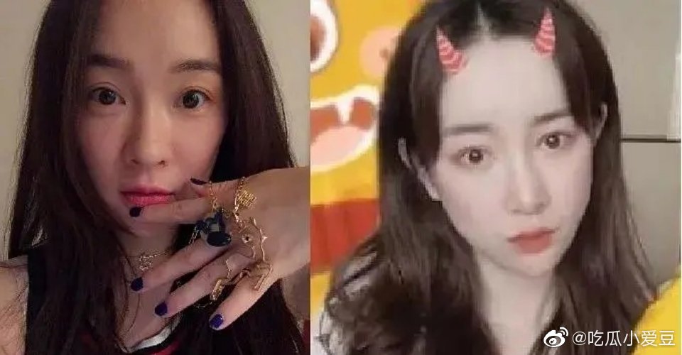 隐婚3年流产2次，遭丈夫家暴出轨，今患抑郁疑服药自杀昏迷20分钟