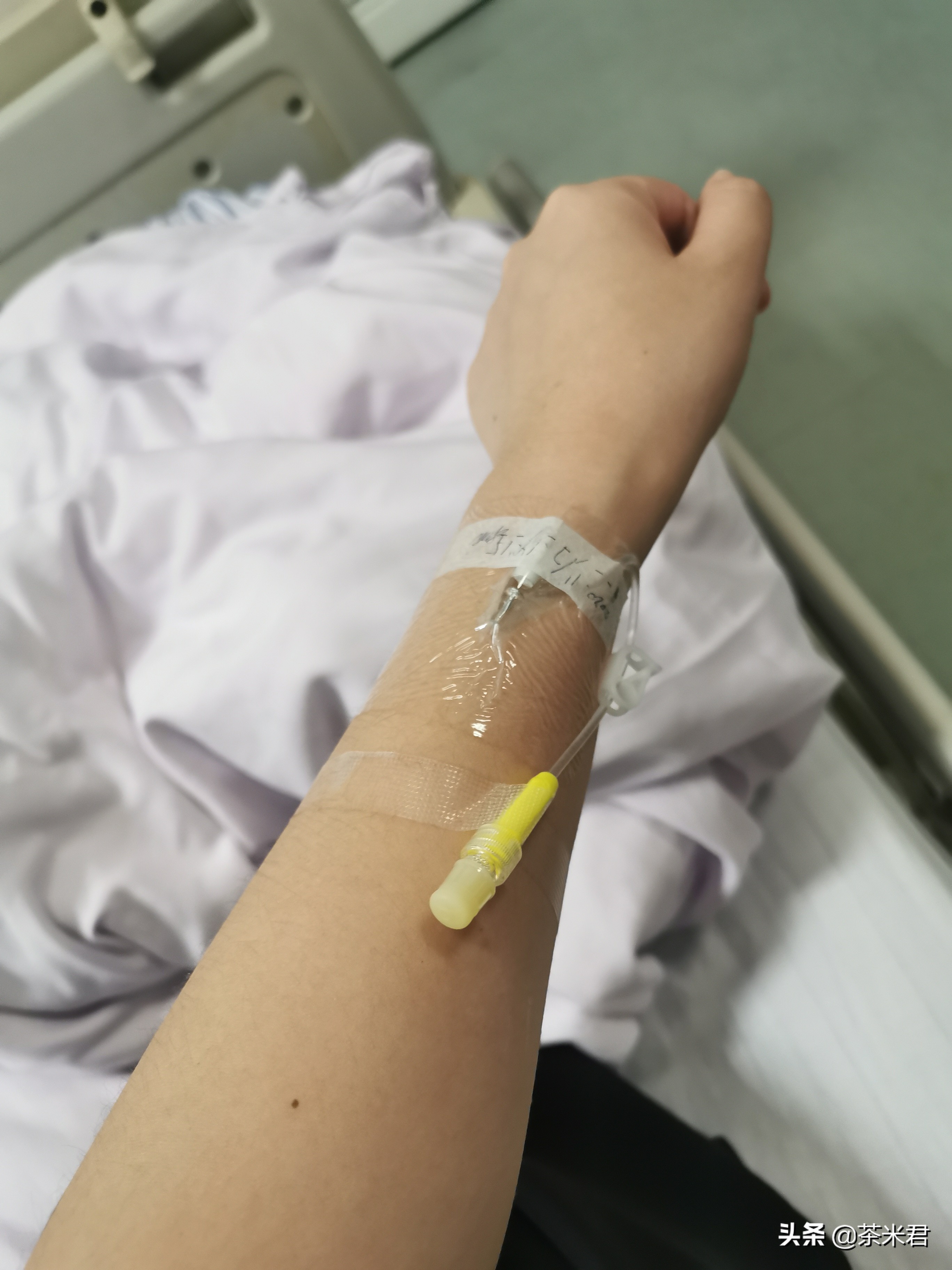 滞留针多少钱(住院) - 价格百科