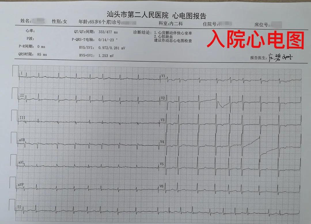 射频消融术让房颤患者重获“心”声