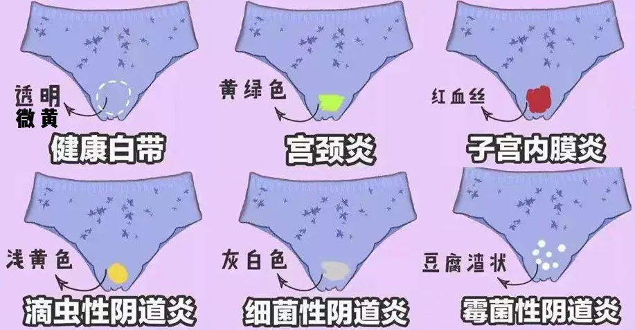 啪啪啪时私处有“味”？味从哪里来？为了另一半，建议你看完全篇