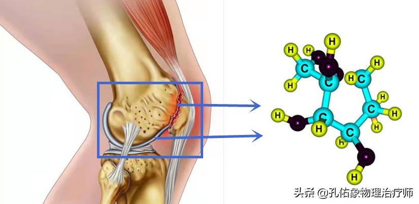 膝关节疼痛的元凶是什么？骨性关节炎吗？要如何应对？请看此文