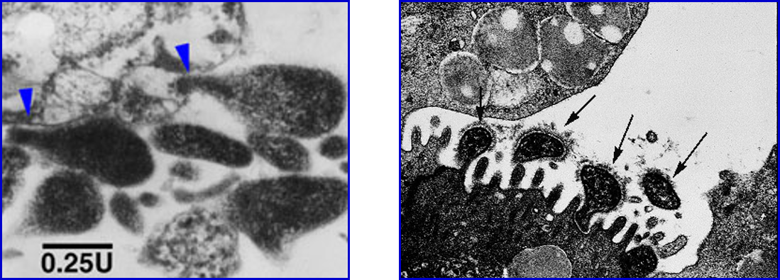 支原体丨虽不会引起猪的死亡，却是其它呼吸系统疾病的导火索！