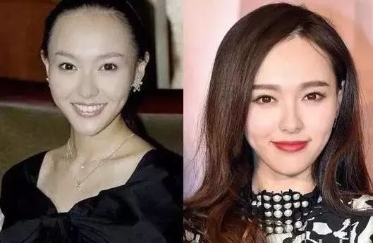 拯救高发际线的四大方法，你用过哪个？敢选最后一个的都是勇士
