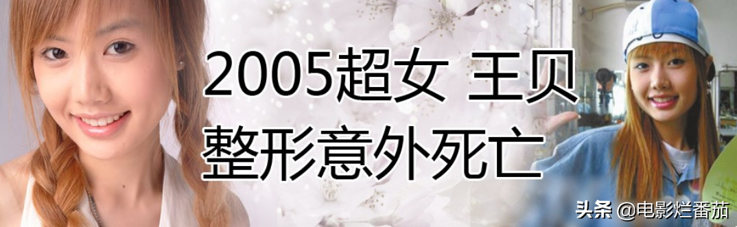 8位女星的整容“塌房路”：有人葬送事业，有人毁容，张檬可惜了