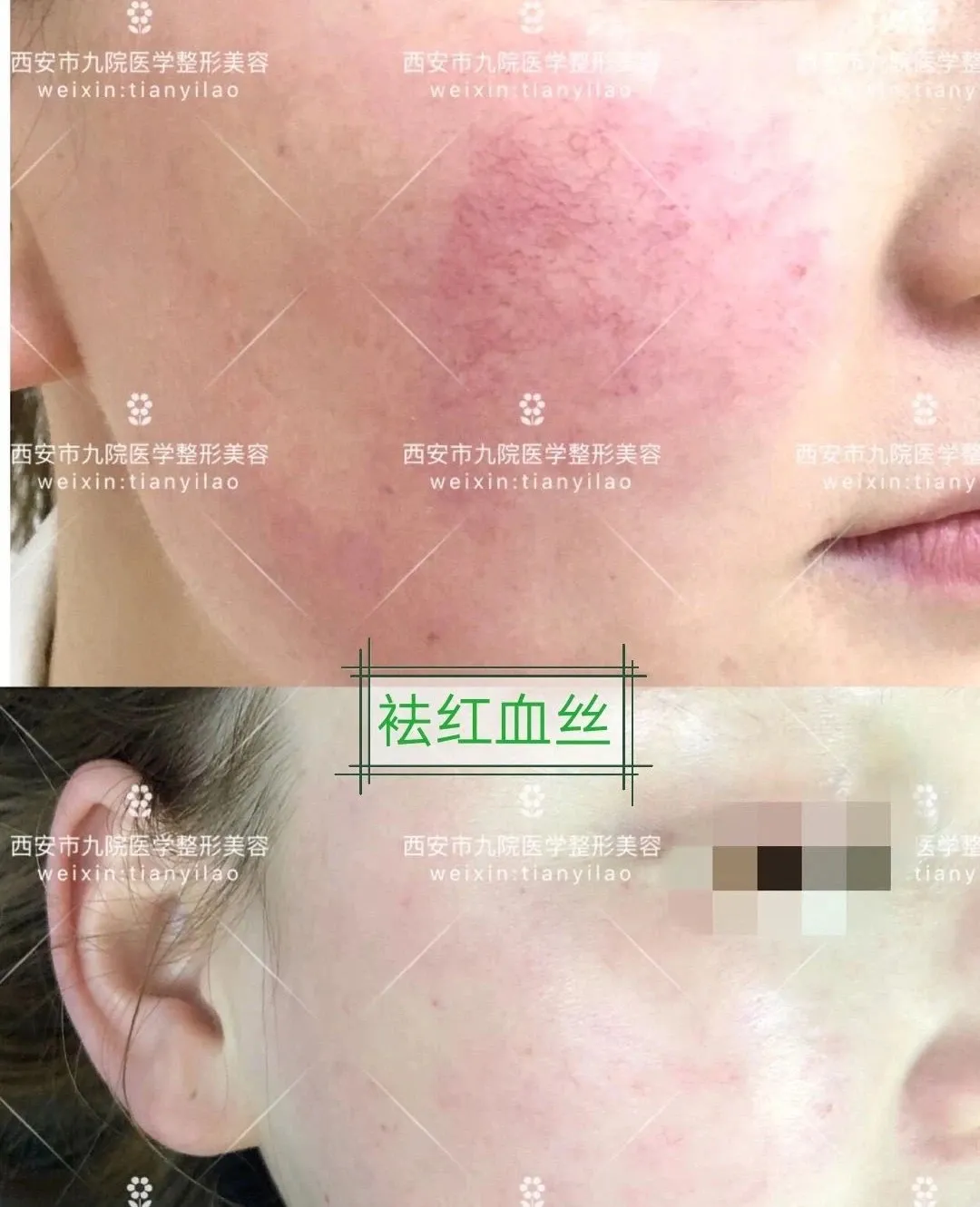 【活动播报】西安市第九医院“暑期特惠”活动启动啦!