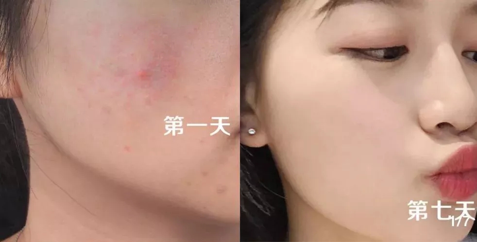 王艳、秦海璐、刘亦菲都在用片仔癀，谁用谁白，受到众多明星青睐