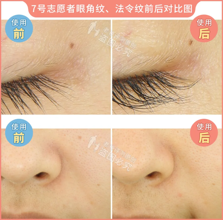 网红家用美容仪真的有效吗？2个多月的跟踪实测结果来了