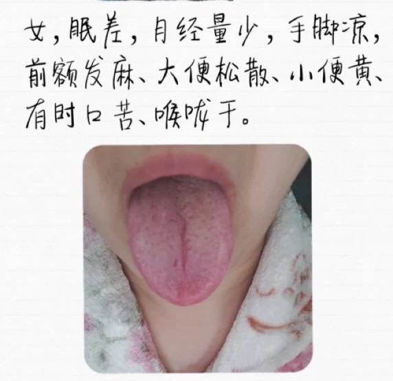 舌头有裂纹是怎么回事？常见的裂纹舌辩证，看看你是哪一种？
