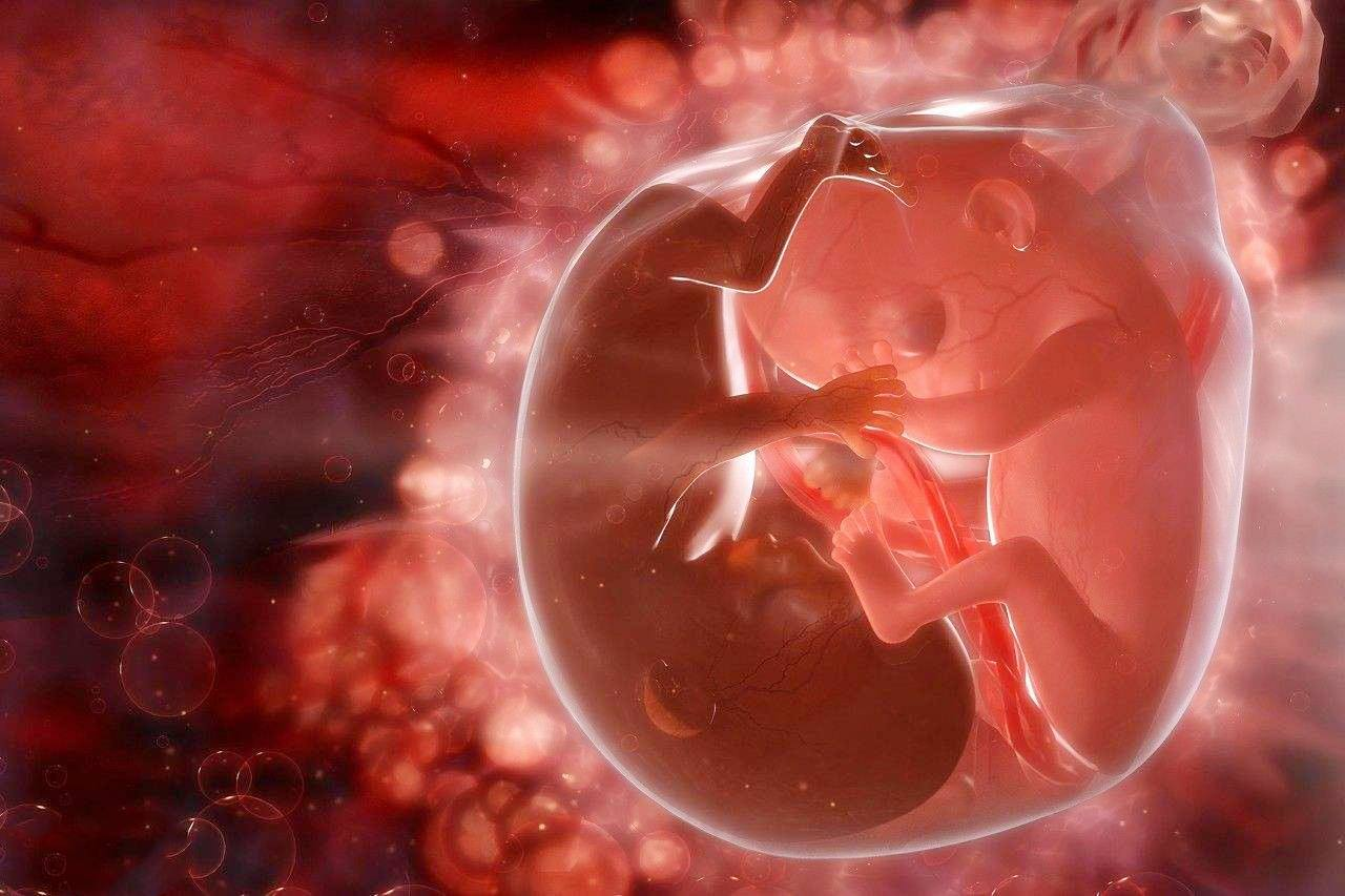 女子怀双胞胎:一个不幸流产,另一个保胎120天后降生