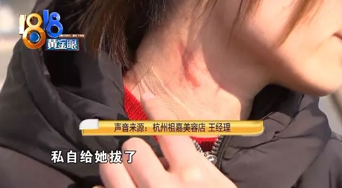 美容店里拔火罐，酒精洒出身上多处被烧伤，回应：员工个人行为