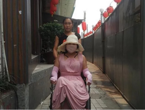 耗费400多万，整容200多次，最后沦落到坐轮椅，乳房险些被切除