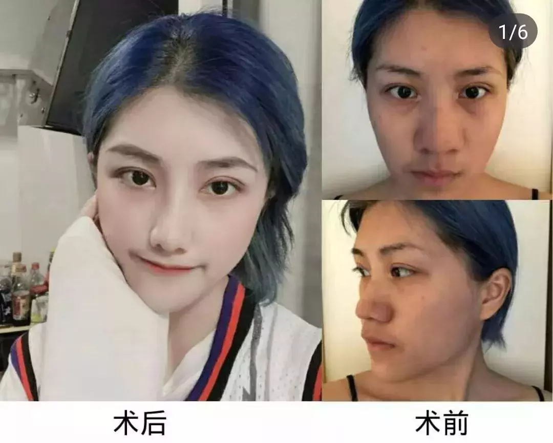 最漂亮的3种鼻子,第1种很少有人有