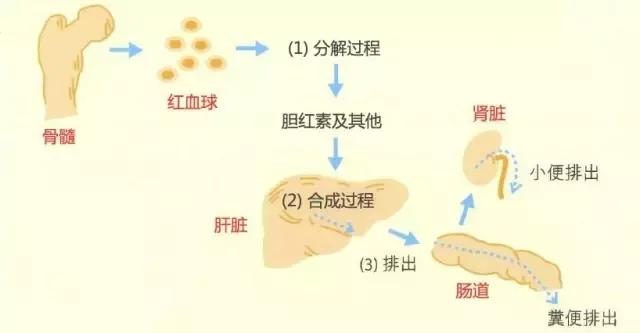 黄疸多晒太阳就好？不重视黄疸致宝宝脑瘫，有这8个症状要注意了