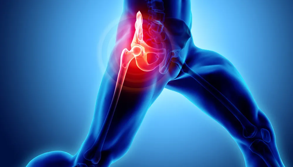 7个动作自测"股骨头"损耗,大腿根隐隐作痛的人要当心了