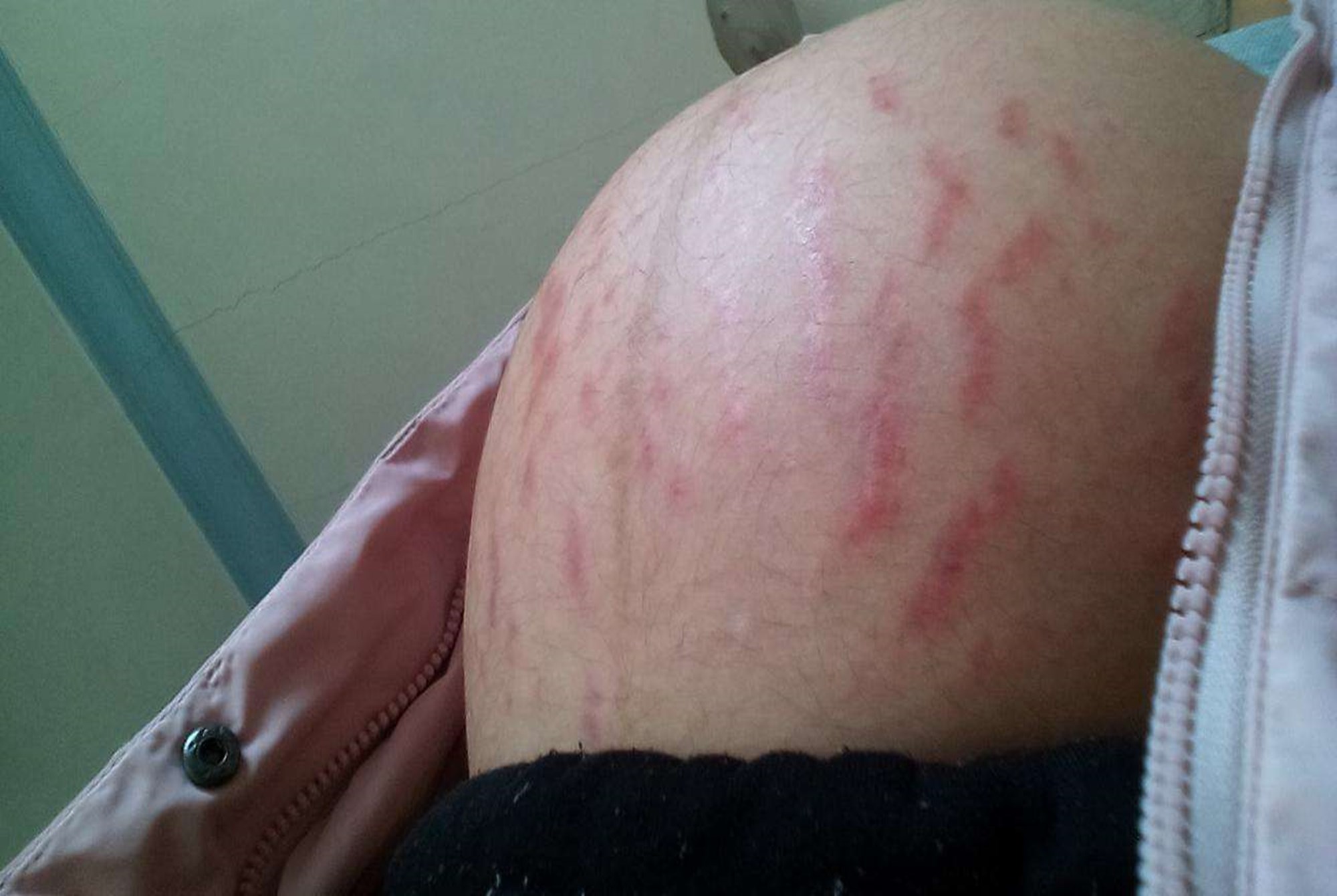 妊娠纹是"看人下菜碟"?符合四大标准女性,恭喜你完美避开了