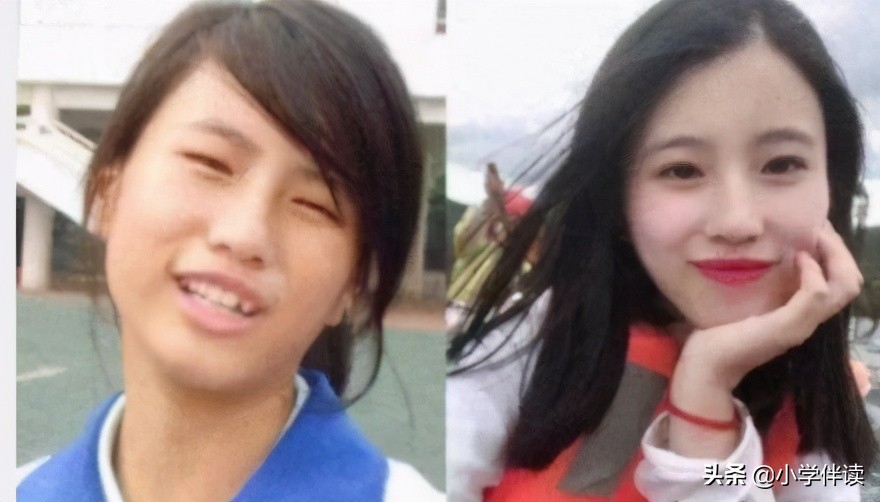 北大不如胸大？暑假整容已接近疯狂，颜值“内卷”不输辅导班