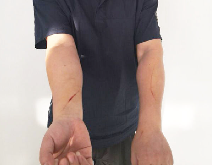 诬赖民警“强奸”，划伤6民警，扬州一农妇上演“教科书式”耍赖