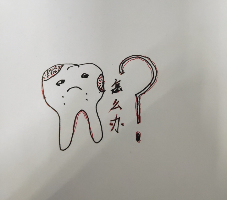 口腔医生耐心画图为你解答|牙齿龋病的正规治疗方式