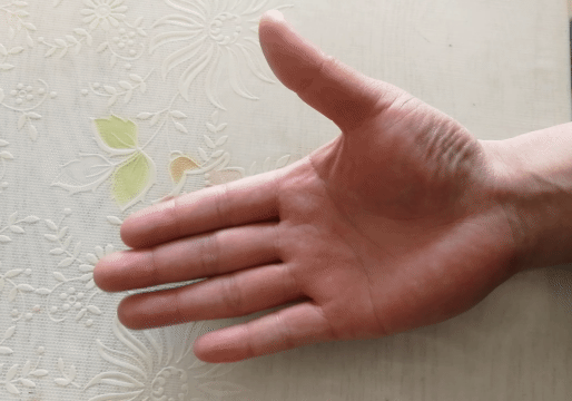 中老年女性常手指疼痛、肿胀，是腱鞘炎吗？该怎么办？告知您