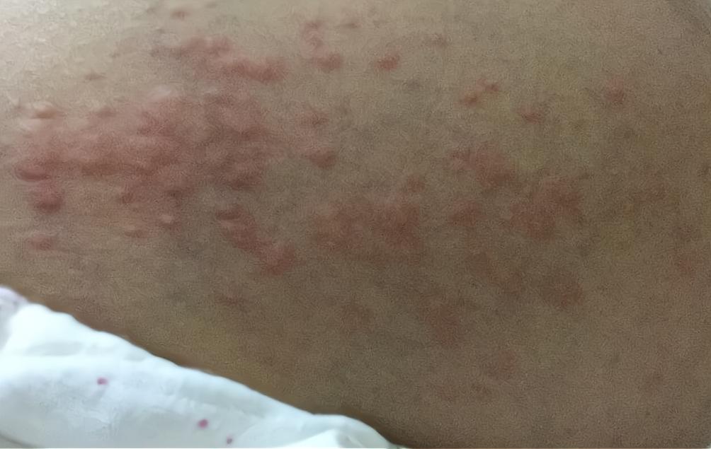 妊娠纹不会无缘无故出现:做好这几个准备,产后也能美美哒