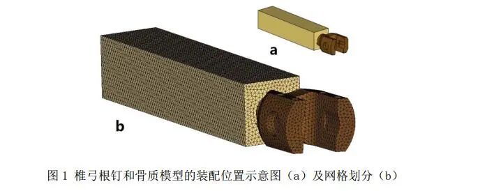 有限元法在椎弓根钉强度中的应用