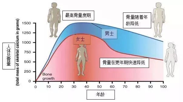 骨质疏松只发生在老年人身上?大错特错