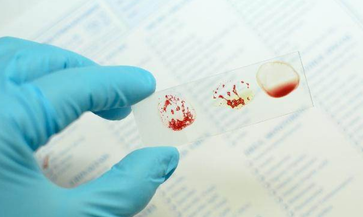 ab型血为什么叫贵族血 ab血型的人极为可怕-大连号