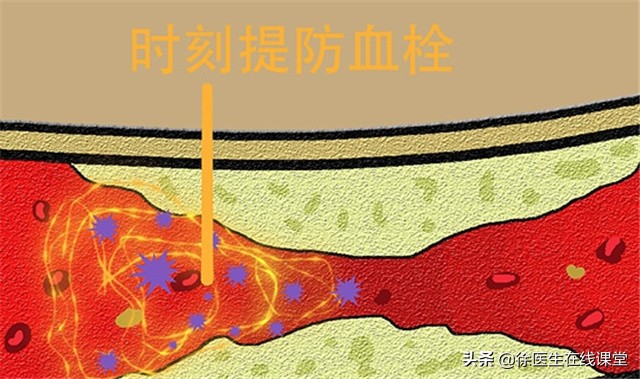 看不懂血脂检查单？这4项指标最重要！有一个超标，就要留心