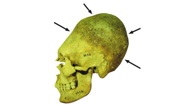 埃及足总证实(中欧国家匈牙利出土长着超长头骨的“人类”，他们是外星人吗？)