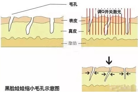 黑脸娃娃怎么做效果更好，做黑脸娃娃的步骤