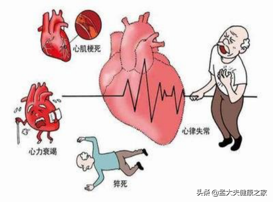 冠心病心脏缺血治疗：服用两种药物缓解症状