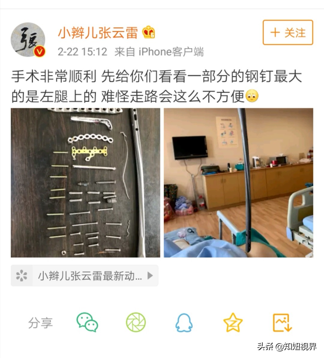 退赛遭质疑，带100多根钢钉上台，大难不死他何时华丽归来？