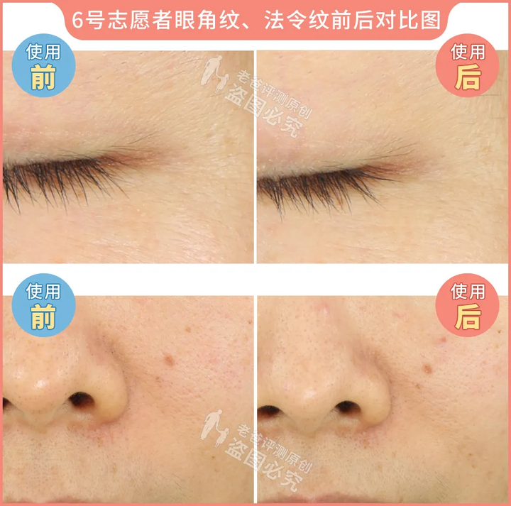网红家用美容仪真的有效吗？2个多月的跟踪实测结果来了
